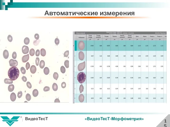 Автоматические измерения 15 «ВидеоТесТ-Морфометрия»