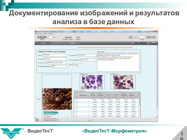 Документирование изображений и результатов анализа в базе данных 16 «ВидеоТесТ-Морфометрия»