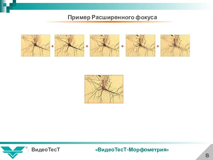 8 «ВидеоТесТ-Морфометрия» Пример Расширенного фокуса