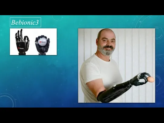 Bebionic3