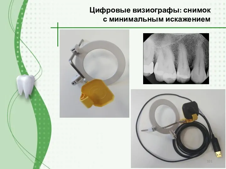 Цифровые визиографы: снимок с минимальным искажением