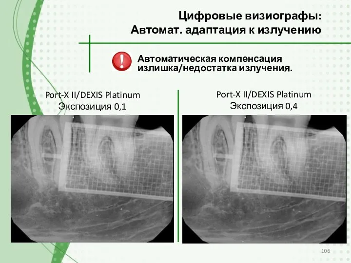 Автоматическая компенсация излишка/недостатка излучения. Цифровые визиографы: Автомат. адаптация к излучению