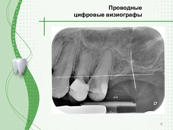 Проводные цифровые визиографы