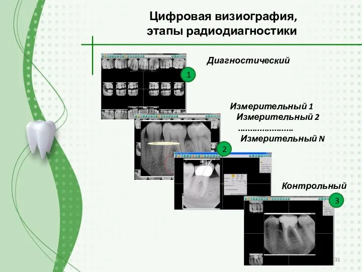 Цифровая визиография, этапы радиодиагностики Контрольный Диагностический Измерительный 1 Измерительный 2 ....................... Измерительный N