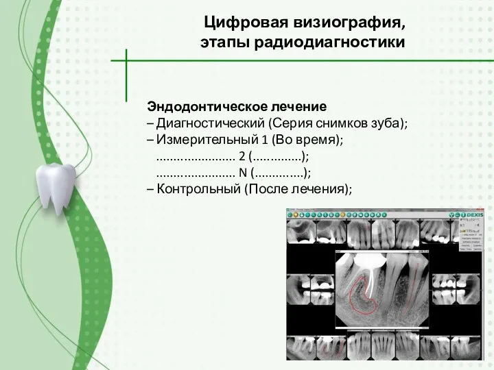 Эндодонтическое лечение – Диагностический (Серия снимков зуба); – Измерительный 1 (Во