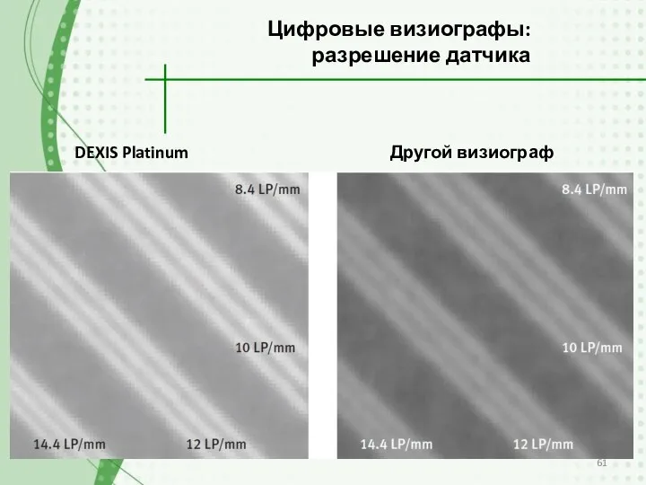 Цифровые визиографы: разрешение датчика DEXIS Platinum Другой визиограф