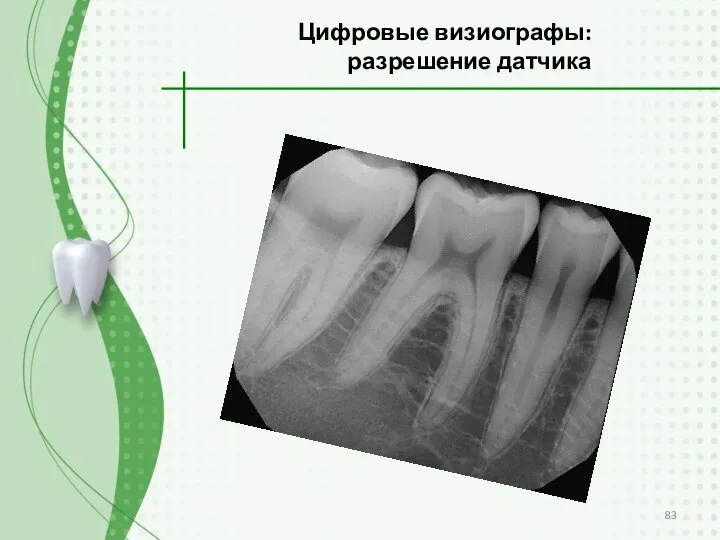 Цифровые визиографы: разрешение датчика