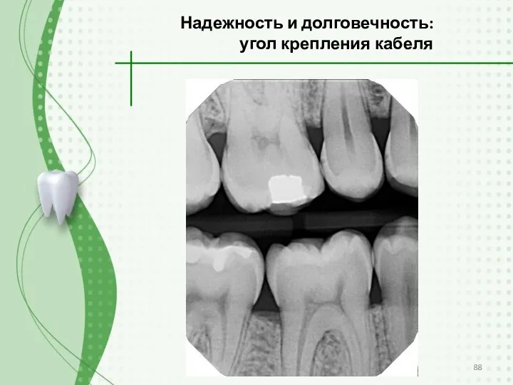 Надежность и долговечность: угол крепления кабеля