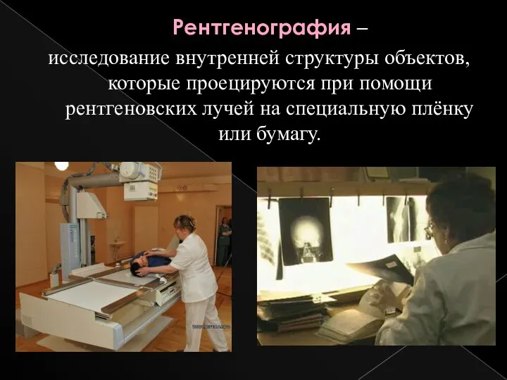 Рентгенография – исследование внутренней структуры объектов, которые проецируются при помощи рентгеновских