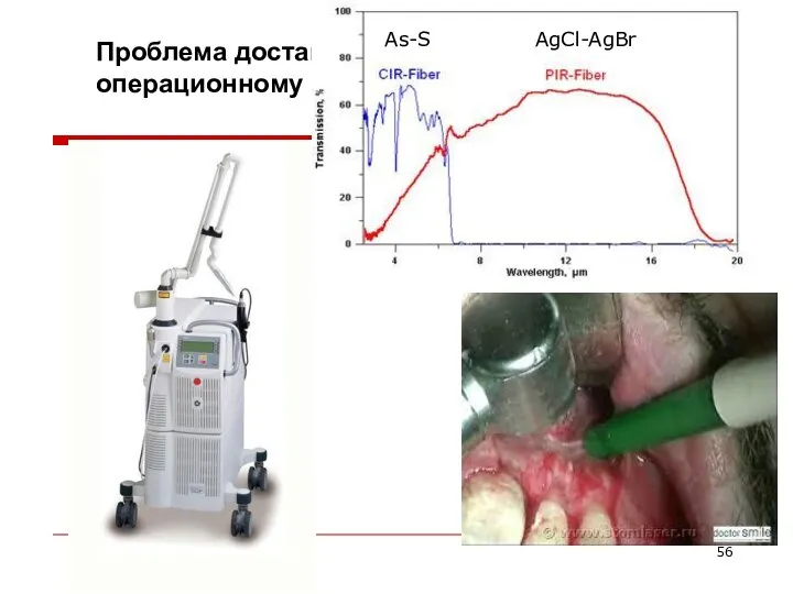 Er:YAG Chalcogenide As-S glasses Проблема доставки 3-микронного излучения к операционному полю