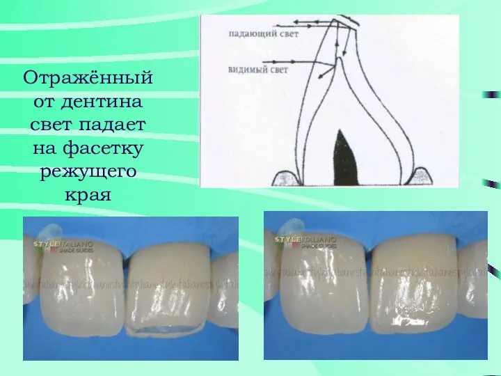 Отражённый от дентина свет падает на фасетку режущего края