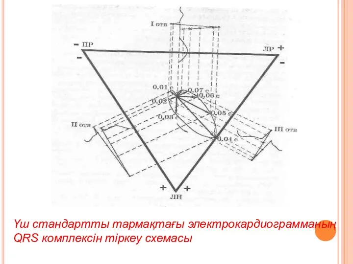 Үш стандартты тармақтағы электрокардиограмманың QRS комплексін тіркеу схемасы