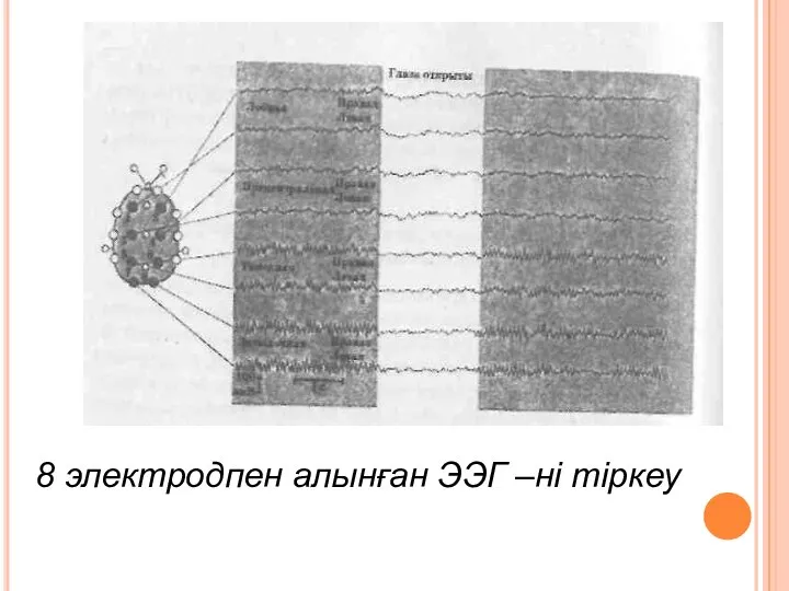 8 электродпен алынған ЭЭГ –ні тіркеу