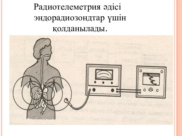 Радиотелеметрия әдісі эндорадиозондтар үшін қолданылады.