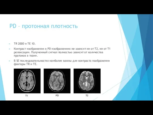 PD – протонная плотность TR 2000 и TE 10. Контраст изображения