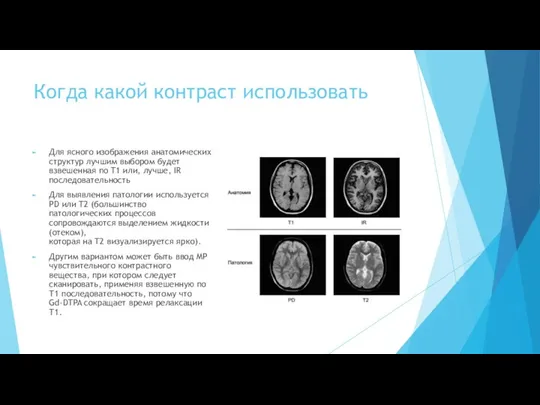 Когда какой контраст использовать Для ясного изображения анатомических структур лучшим выбором