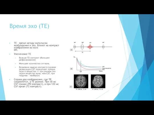 Время эхо (TE) TE – время между импульсом возбуждения и эхо.