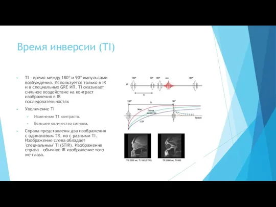 Время инверсии (TI) TI – время между 180º и 90º импульсами