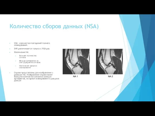 Количество сборов данных (NSA) NSA - количество повторений полного cканирования. SNR