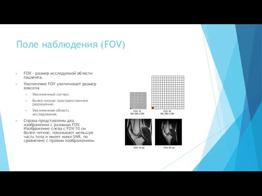 Поле наблюдения (FOV) FOV - размер исследуемой области пациента. Увеличение FOV