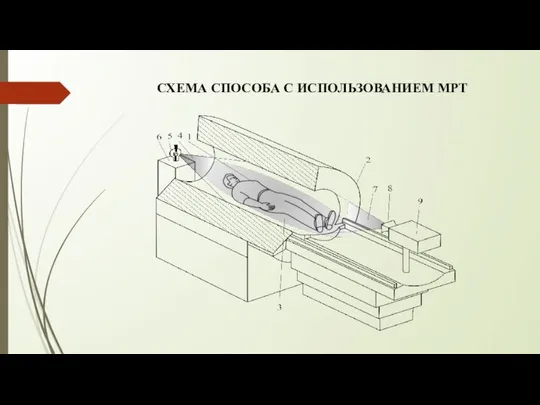 СХЕМА СПОСОБА С ИСПОЛЬЗОВАНИЕМ МРТ