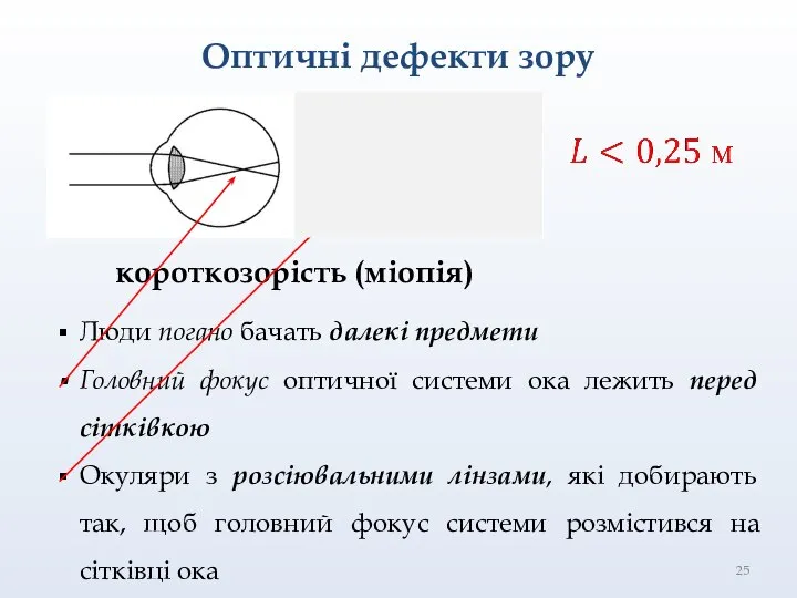 Оптичні дефекти зору короткозорість (міопія) Люди погано бачать далекі предмети Головний