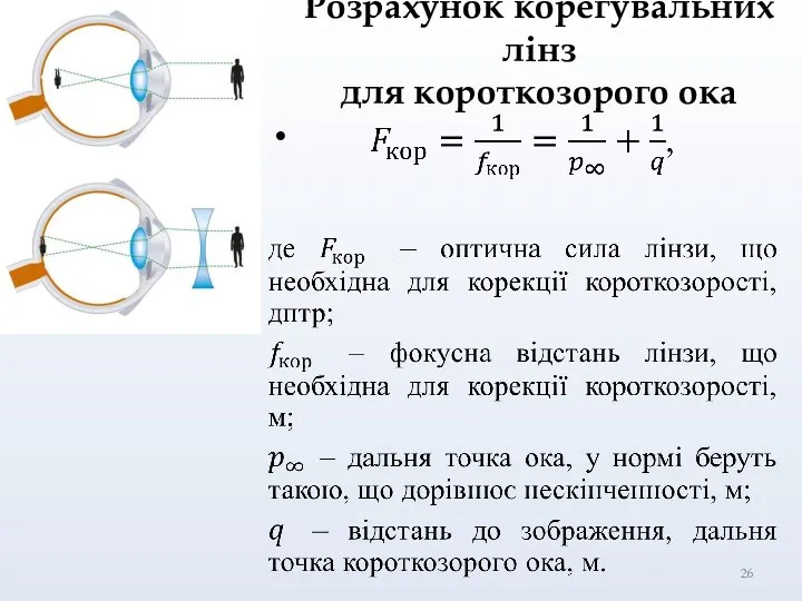 Розрахунок корегувальних лінз для короткозорого ока