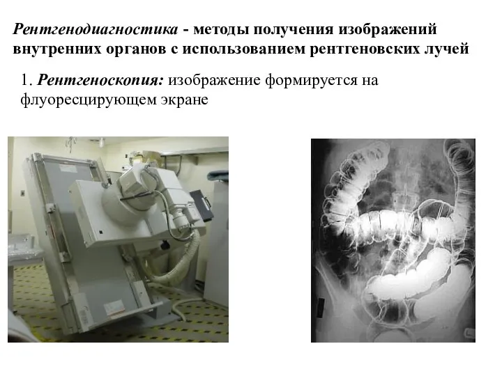 Рентгенодиагностика - методы получения изображений внутренних органов с использованием рентгеновских лучей