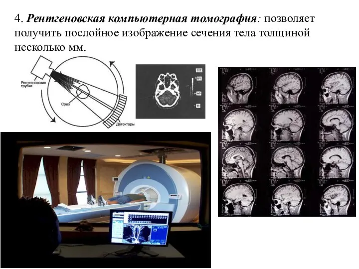 4. Рентгеновская компьютерная томография: позволяет получить послойное изображение сечения тела толщиной несколько мм.
