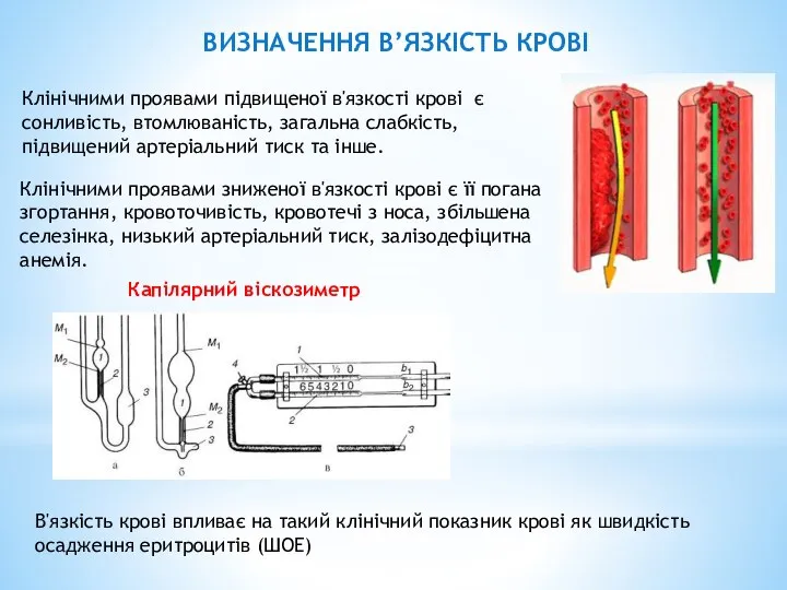 Клінічними проявами підвищеної в'язкості крові є сонливість, втомлюваність, загальна слабкість, підвищений