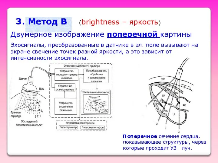 3. Метод B (brightness – яркость) Двумерное изображение поперечной картины Поперечное