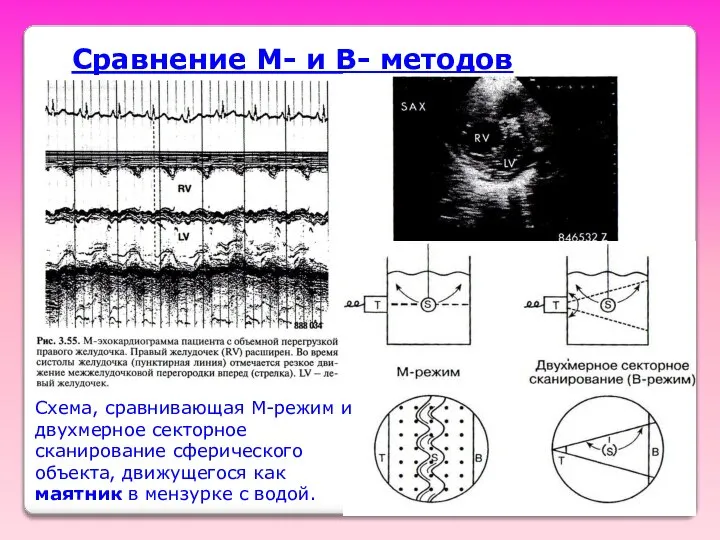 Сравнение M- и B- методов Схема, сравнивающая M-режим и двухмерное секторное