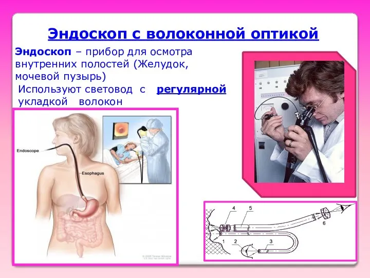 Эндоскоп с волоконной оптикой Эндоскоп – прибор для осмотра внутренних полостей