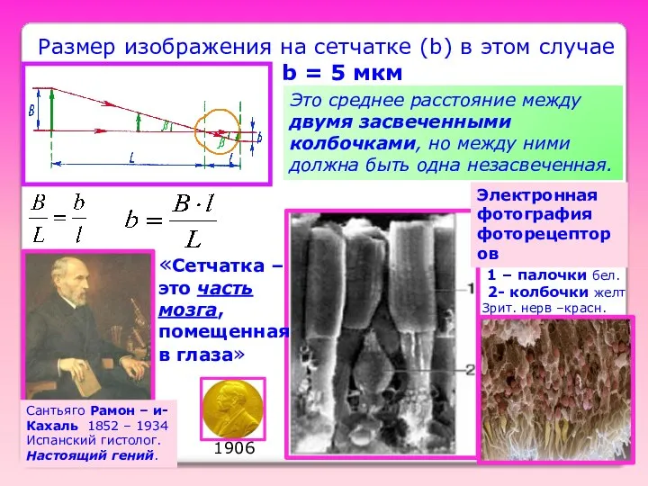 Размер изображения на сетчатке (b) в этом случае b = 5