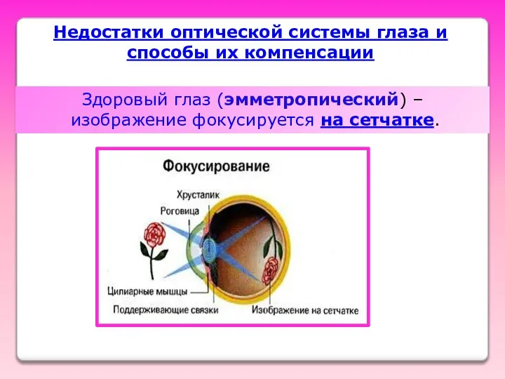 Недостатки оптической системы глаза и способы их компенсации Здоровый глаз (эмметропический) – изображение фокусируется на сетчатке.