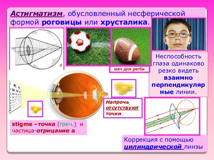 Коррекция с помощью цилиндрической линзы Астигматизм, обусловленный несферической формой роговицы или