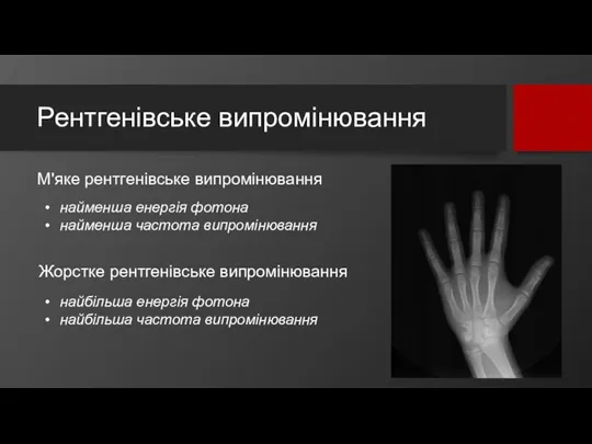 Рентгенівське випромінювання М'яке рентгенівське випромінювання найменша енергія фотона найменша частота випромінювання