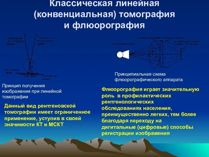 Классическая линейная (конвенциальная) томография и флюорография Принцип получения изображения при линейной