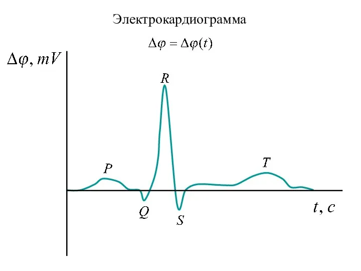 Электрокардиограмма