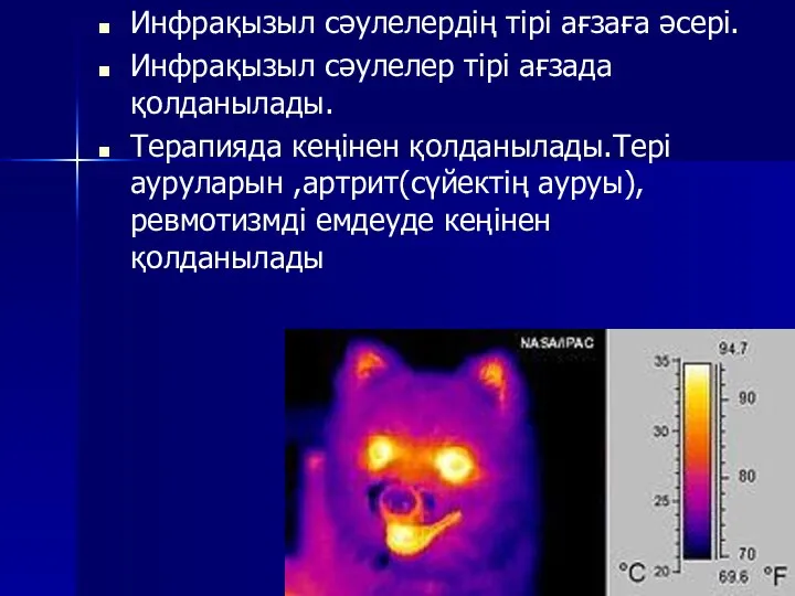 Инфрақызыл сәулелердің тірі ағзаға әсері. Инфрақызыл сәулелер тірі ағзада қолданылады. Терапияда