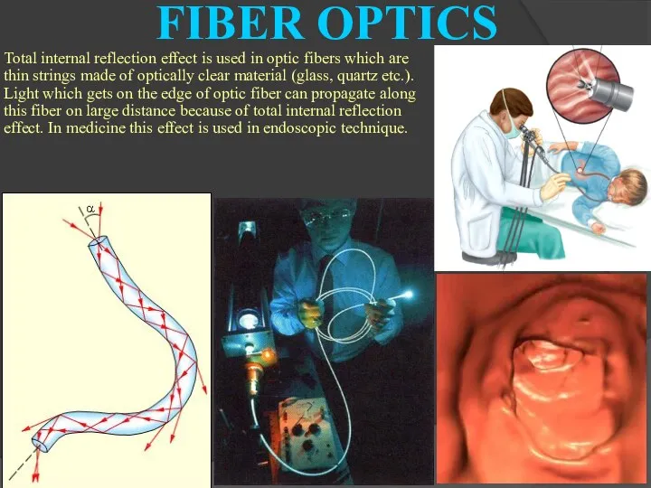 Total internal reflection effect is used in optic fibers which are