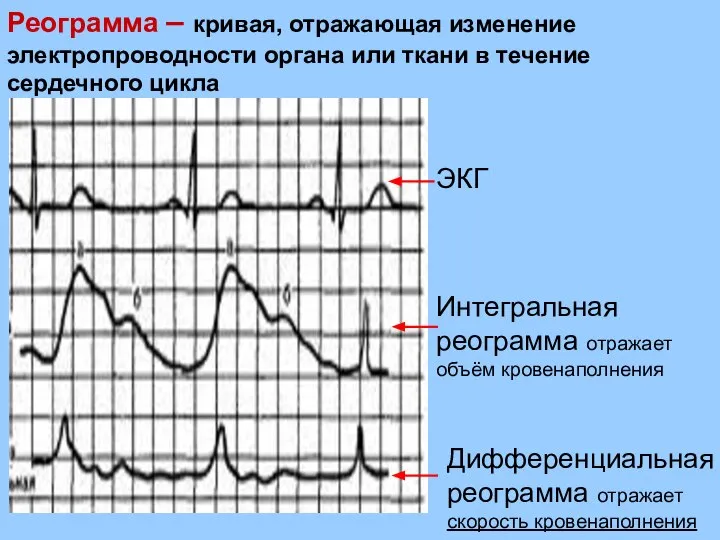 Реограмма – кривая, отражающая изменение электропроводности органа или ткани в течение
