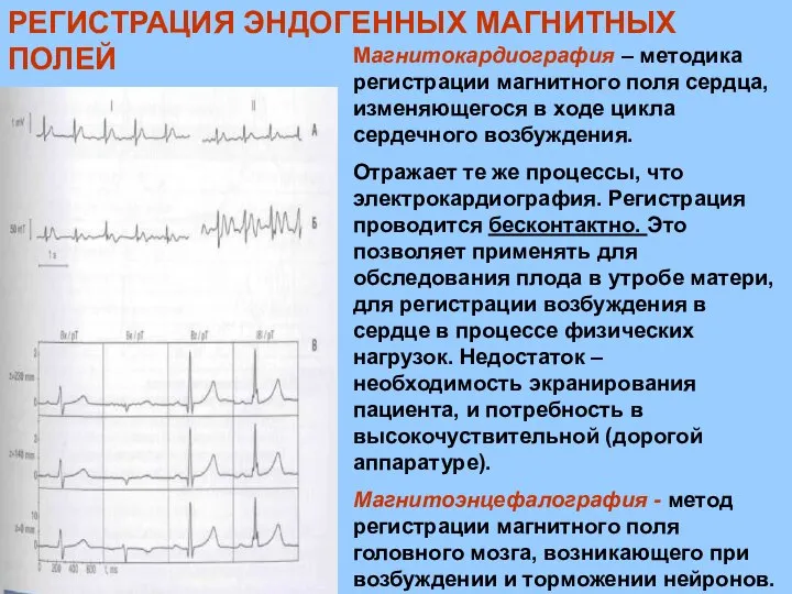 РЕГИСТРАЦИЯ ЭНДОГЕННЫХ МАГНИТНЫХ ПОЛЕЙ Магнитокардиография – методика регистрации магнитного поля сердца,