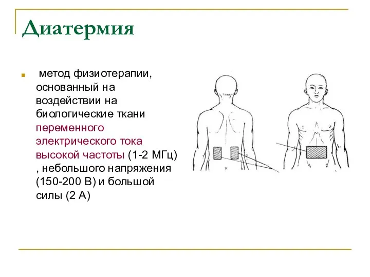 Диатермия метод физиотерапии, основанный на воздействии на биологические ткани переменного электрического