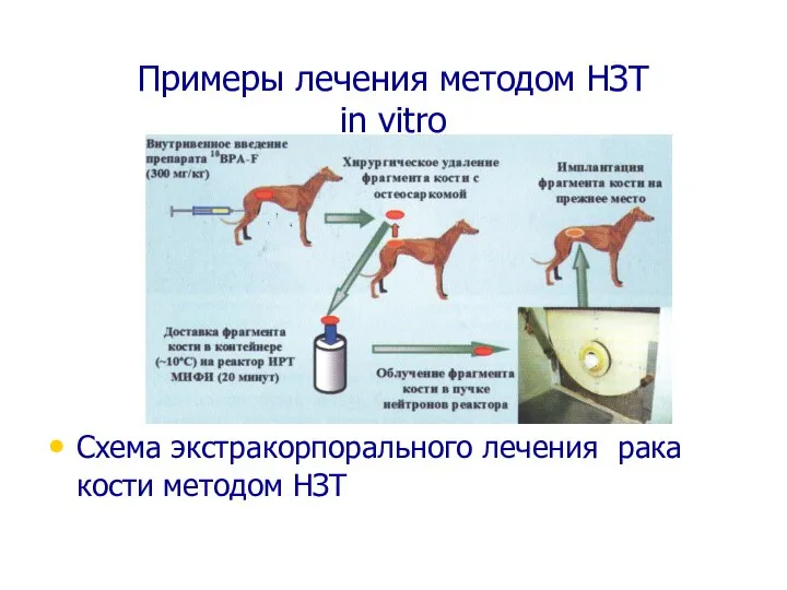 Примеры лечения методом НЗТ in vitro Схема экстракорпорального лечения рака кости методом НЗТ