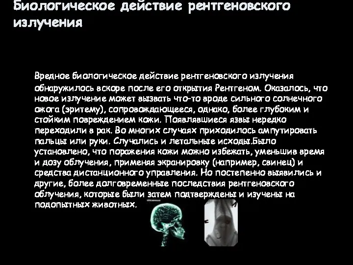 Биологическое действие рентгеновского излучения Вредное биологическое действие рентгеновского излучения обнаружилось вскоре