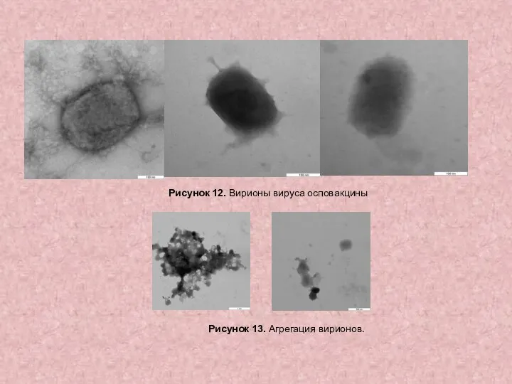 Рисунок 12. Вирионы вируса осповакцины Рисунок 13. Агрегация вирионов.