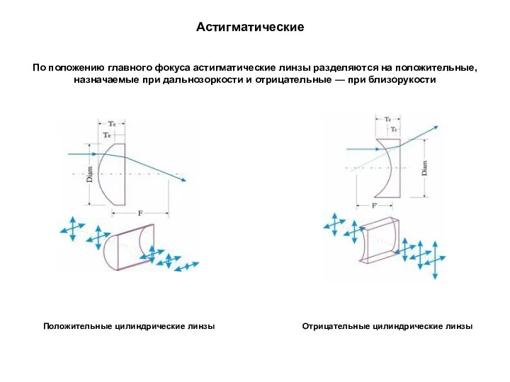 Астигматические По положению главного фокуса астигматические линзы разделяются на положительные, назначаемые