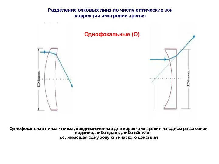 Однофокальные (О) Однофокальная линза - линза, предназначенная для коррекции зрения на