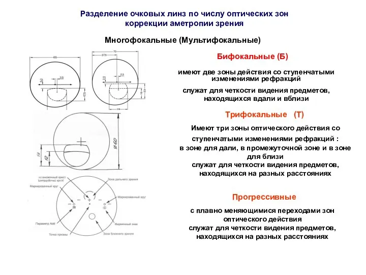 Бифокальные (Б) имеют две зоны действия со ступенчатыми изменениями рефракций служат